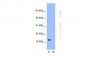 RPS16 antibody - N-terminal region